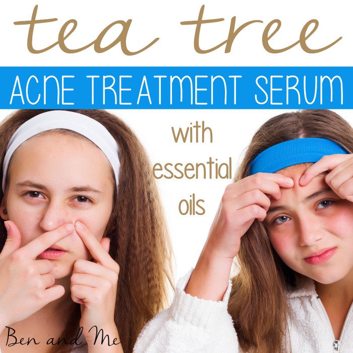 Everyday Uses for Melaleuca (Tea Tree Essential Oil) and an Acne Treatment Serum Recipe